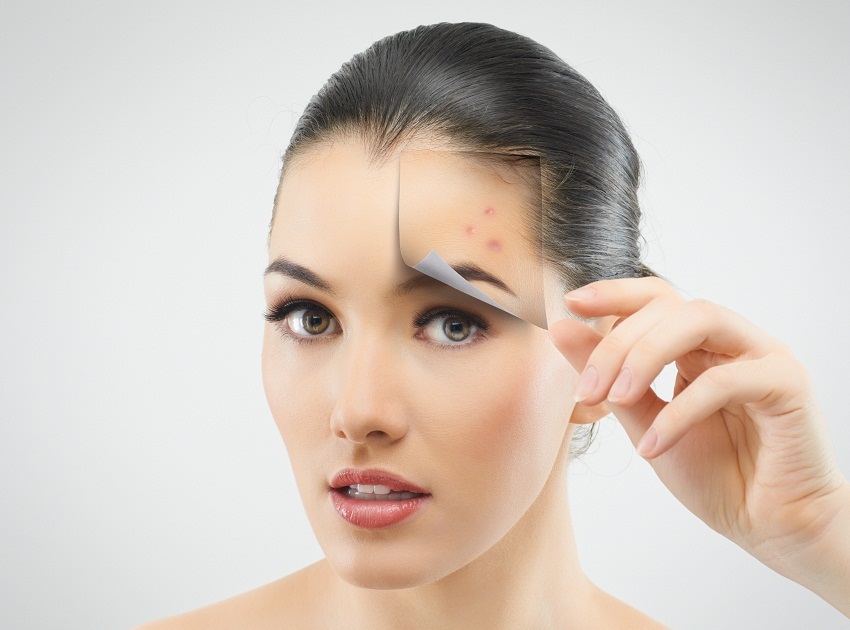 Foods That Can Make Acne Worse | Skin Treatments Dubai