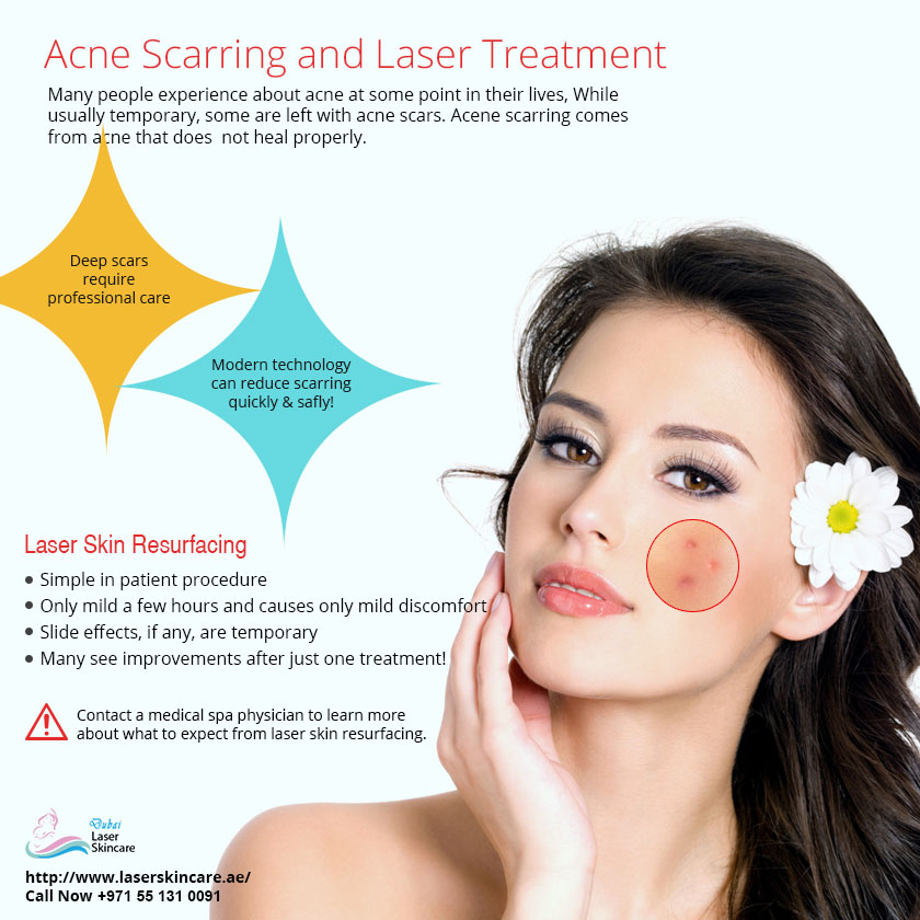 Acne Scars Treatment in Dubai - Sharjah- Abu Dhabi | Skin Treatments Dubai